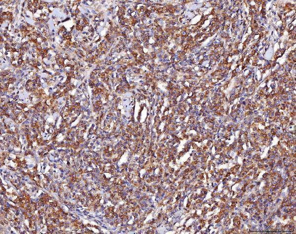 a01250 2 eno1 primary antibodies ihc testing 8