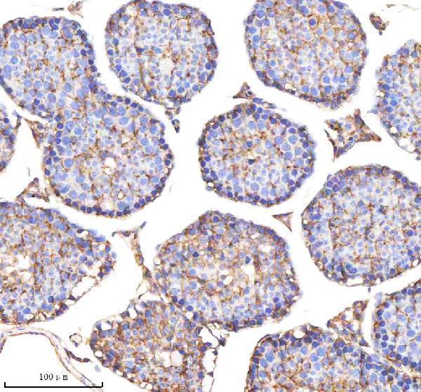  IHC analysis of ENO1 using anti-ENO1 antibody (A01250-3)