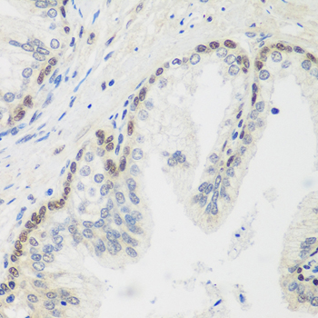 a01252 mdc1 primary antiboties ihc testing 2