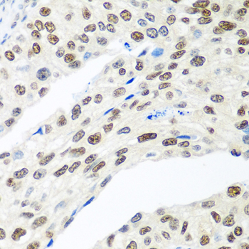 a01252 mdc1 primary antiboties ihc testing 3