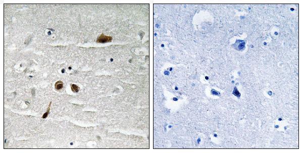 a01252s513 mdc1 primary antibodies ihc testing 2