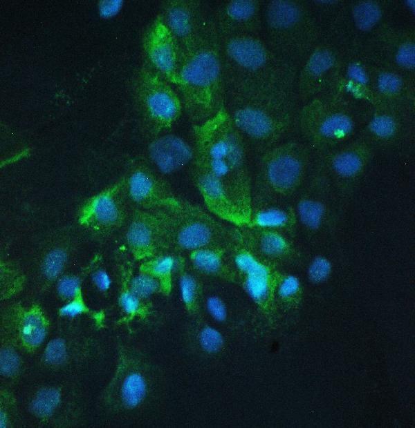 a01253 1 cortactin primary antibodies if testing 19