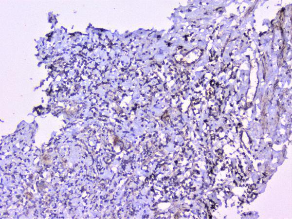 a01253 1 cortactin primary antibodies ihc testing 12