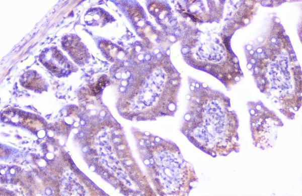 a01253 1 cortactin primary antibodies ihc testing 13