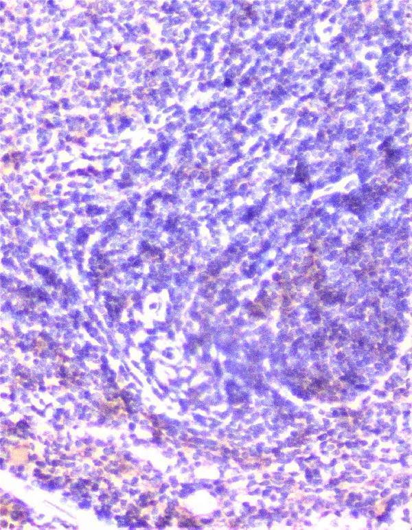 a01253 1 cortactin primary antibodies ihc testing 14