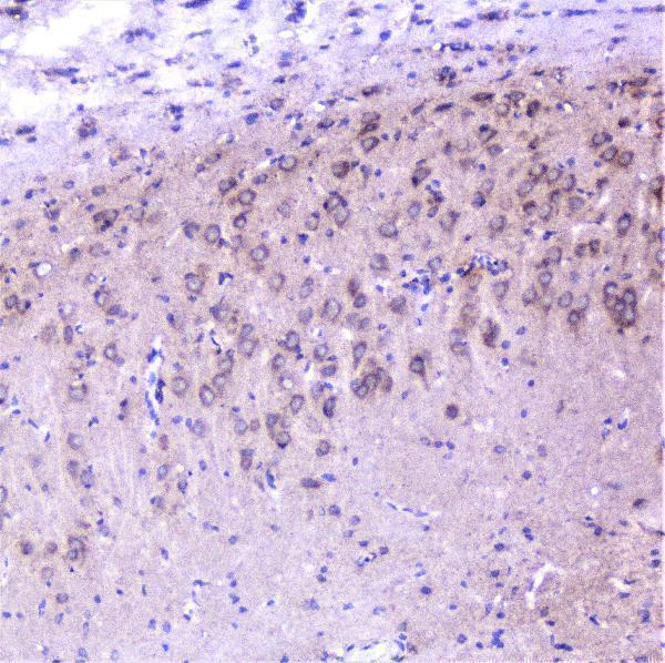 a01253 1 cortactin primary antibodies ihc testing 15