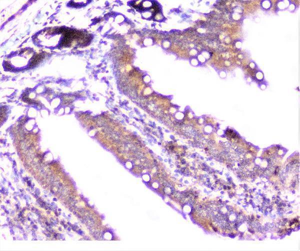 a01253 1 cortactin primary antibodies ihc testing 16