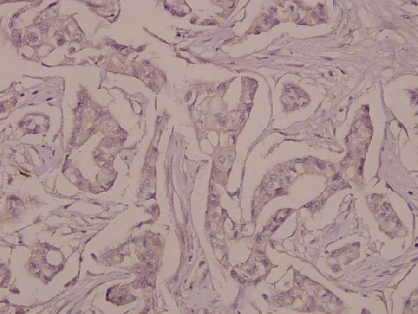 a01253y421 cttn primary antiboties ihc testing 2