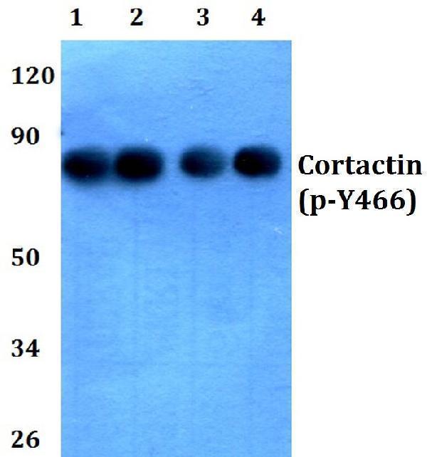 Western blot (WB) analysis of p-Cortactin (Y466) polyclonal antibody at 1:500 dilution
Lane1:HEK293T whole cell lysate
Lane2:Raw264