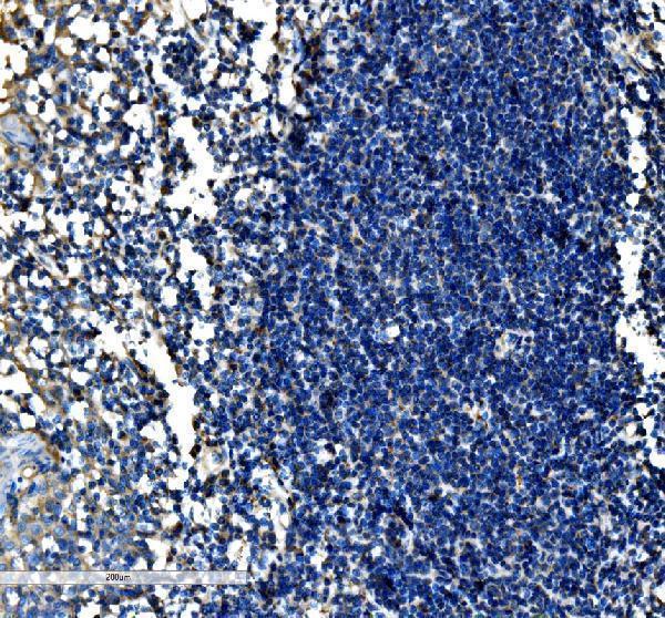 IHC analysis of SCF/KITLG using anti-SCF/KITLG antibody (A01254-1