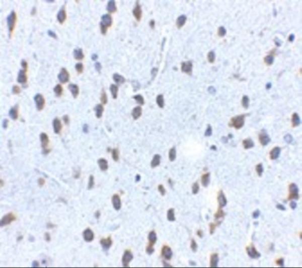 a01254 kitlg primary antibodies ihc testing 3