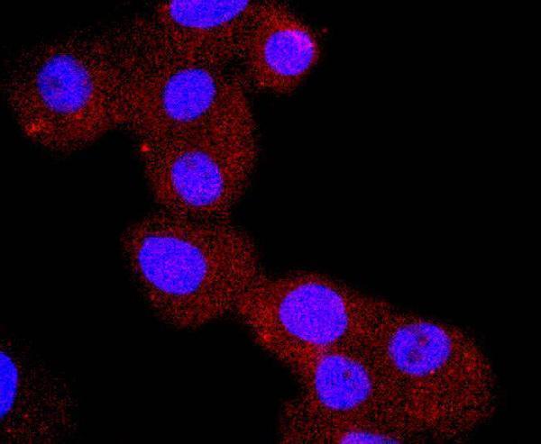ICC staining Chromogranin A in PC-3M cells (red)