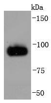 Western blot analysis of Chromogranin A on PC-12 cells lysates using anti-Chromogranin A antibody at 1/1,000 dilution