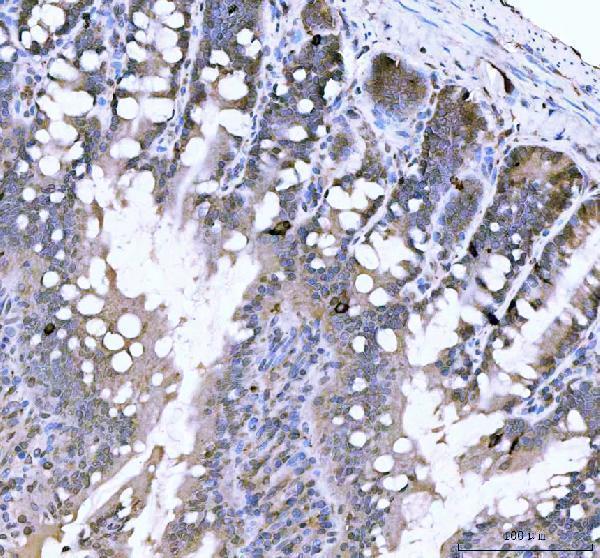 a01256 2 chga primary antibodies ihc testing 2