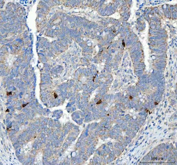  IHC analysis of Chromogranin A/CHGA using anti-Chromogranin A/CHGA antibody (A01256-4)