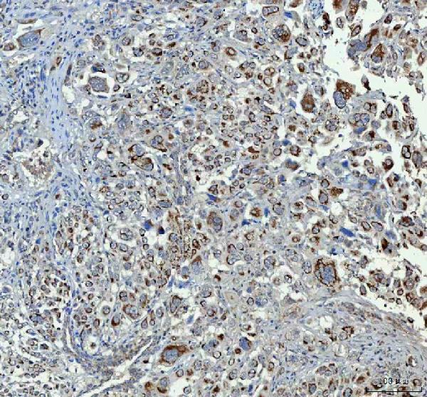 a01256 4 chga primary antibodies ihc testing 3_1