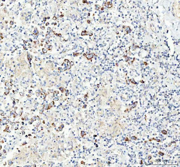 a01256 4 chga primary antibodies ihc testing 4_1