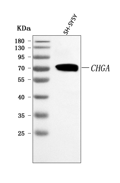  Western blot analysis of Chromogranin A/CHGA using anti-Chromogranin A/CHGA antibody (A01256-4)