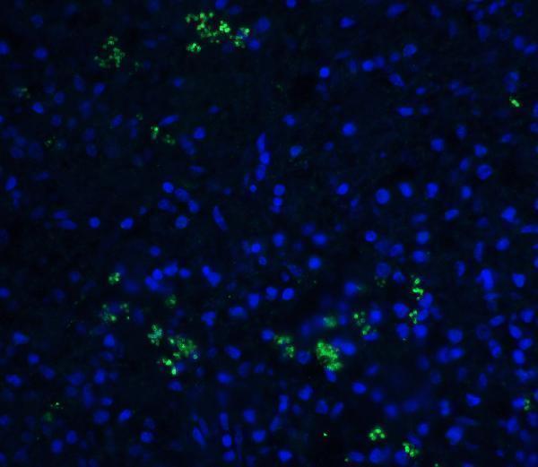 a01257 1 tnfsf13b primary antibodies if testing 5