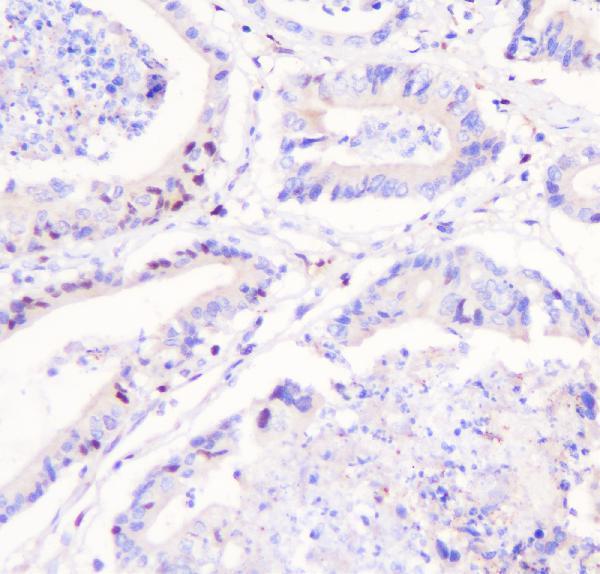 a01258 1 fhl primary antibodies ihc testing 2_1