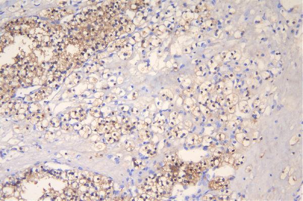 a01258 1 fhl primary antibodies ihc testing 3_1