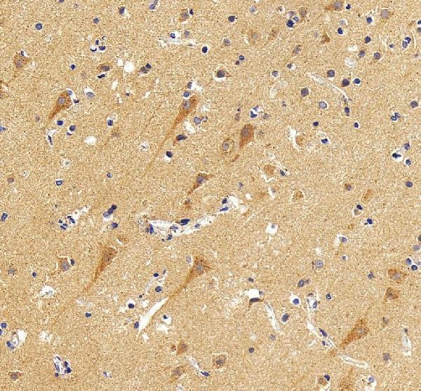 a01259 1 kcnq2 primary antibodies ihc testing 6