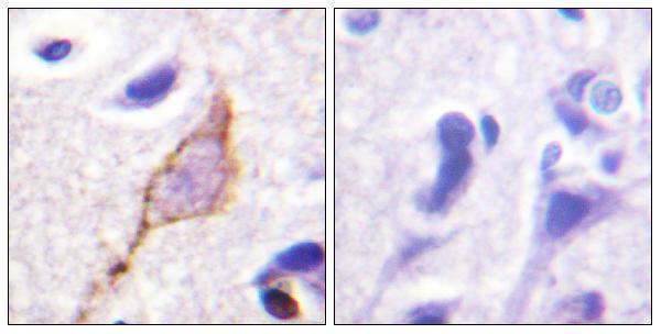 a01259 kcnq2 primary antibodies ihc testing 1
