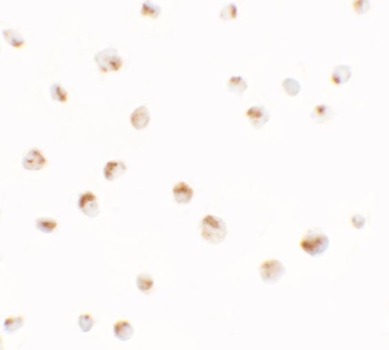 Immunocytochemistry of SDHD in EL4 cells with SDHD antibody at 2