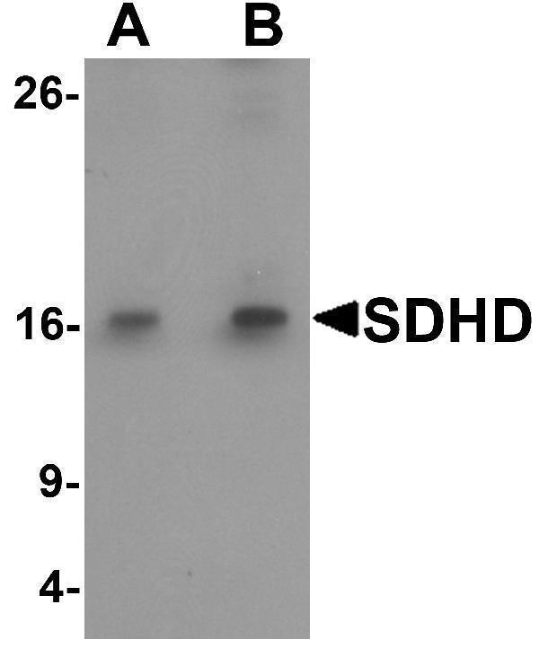 Western blot analysis of SDHD in EL4 cell lysate with SDHD antibody at (A) 1 and (B) 2 μg/mL
