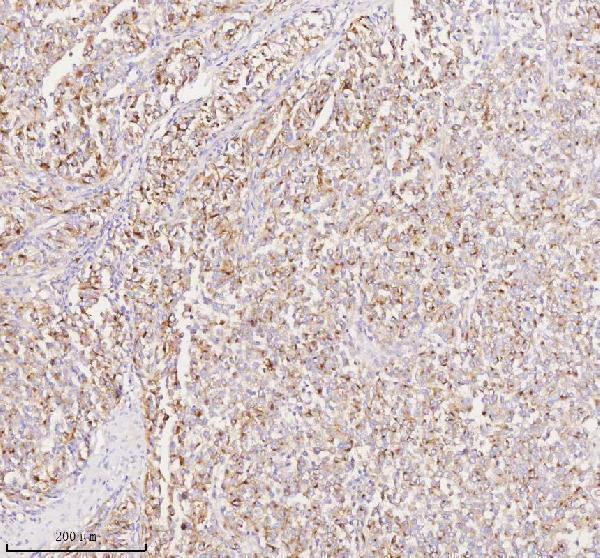 a01262 1 pmel primary antibodies ihc testing 2