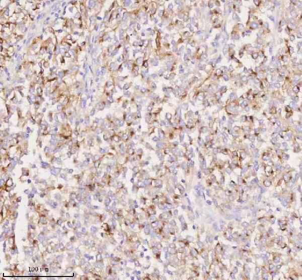 a01262 1 pmel primary antibodies ihc testing 3