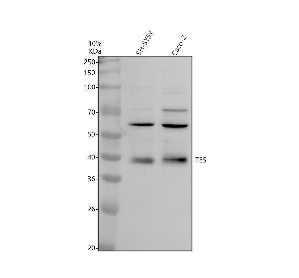 Western blot analysis of TES using anti-TES antibody (A01266-1)