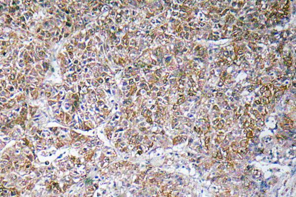 a01267 2 dbi primary antibodies ihc testing 1