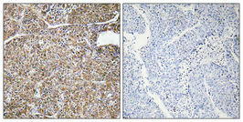 Immunohistochemical analysis of paraffin-embedded Human lung cancer