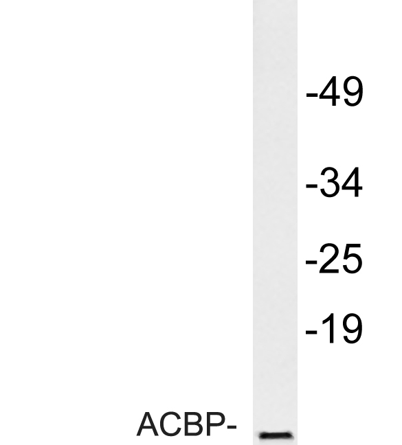 Western blot analysis of lysate fromHuvEc cells, using ACBP antibody
