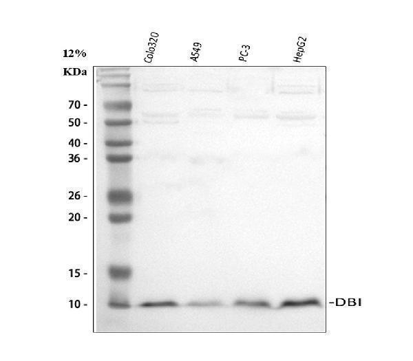  Western blot analysis of DBI using anti-DBI antibody (A01267)