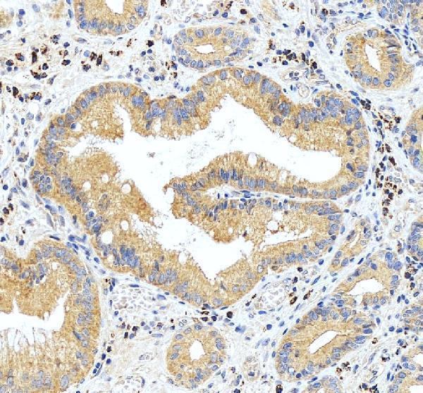 IHC analysis of PDK1 using anti-PDK1 antibody (A01268-1)
