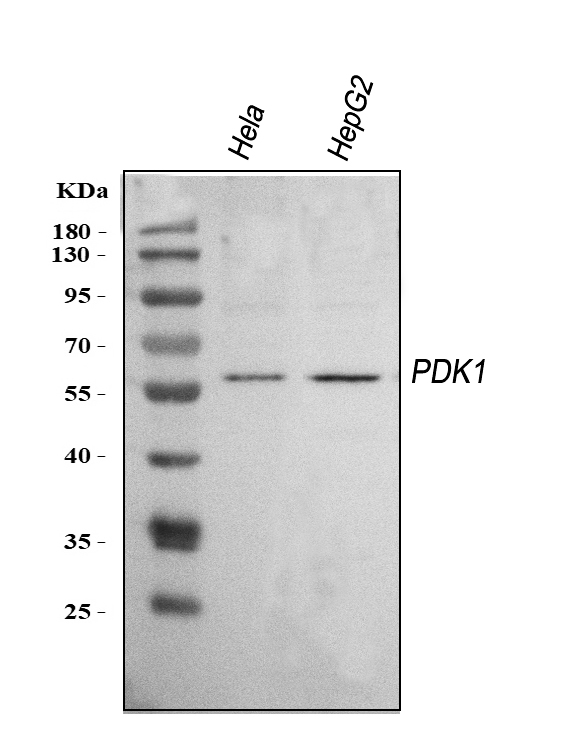  Western blot analysis of PDK1 using anti-PDK1 antibody (A01268-1)