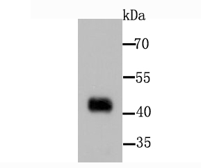 a01268 2 pdk1 primary antiboties wb testing 1