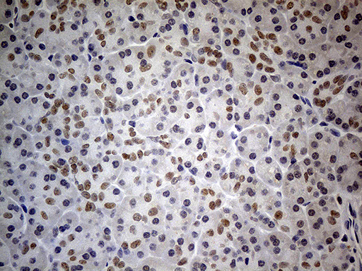 Immunohistochemical staining of paraffin-embedded Human pancreas tissue within the normal limits using anti-HNF1B mouse monoclonal antibody. (Heat-induced epitope retrieval by 1mM EDTA in 10mM Tris buffer (pH8.5) at 120°C for 3min