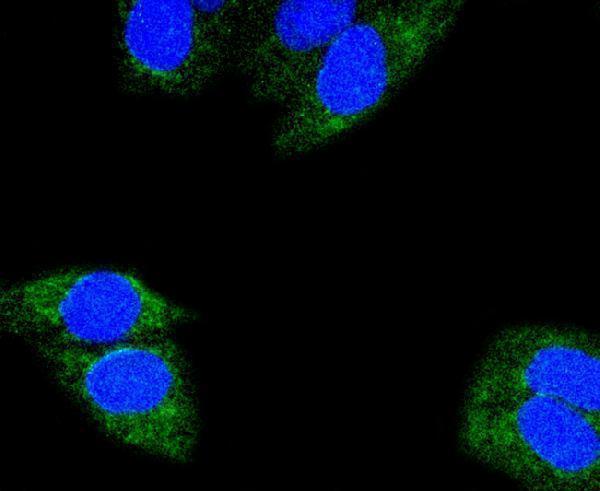 ICC staining Glutaminase in Hela cells (green)