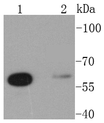 Western blot analysis of Glutaminase on different lysates using anti-Glutaminase antibody at 1/1,000 dilution