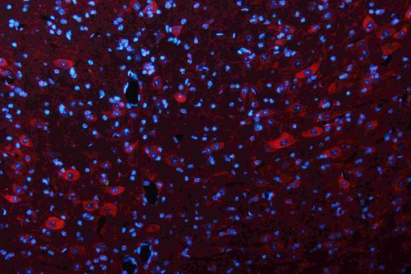 a01272 2 gls primary antibodies if testing 10_1