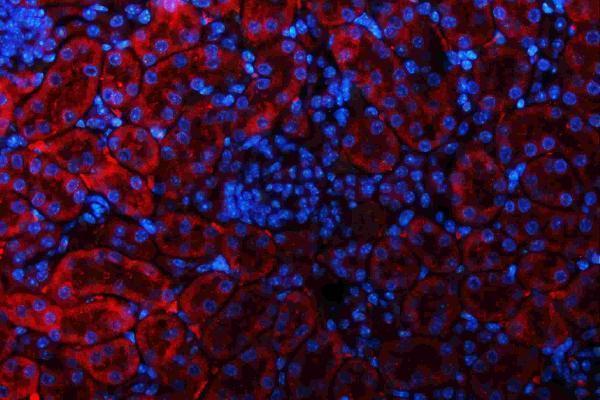 a01272 2 gls primary antibodies if testing 11_1