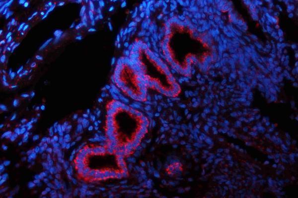 a01272 2 gls primary antibodies if testing 8_1