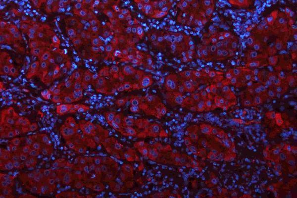 a01272 2 gls primary antibodies if testing 9_1