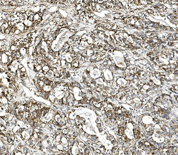 IHC analysis of Glutaminase/GLS using anti-Glutaminase/GLS antibody (A01272-2)