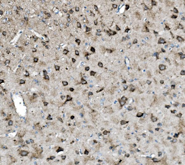 a01272 2 gls primary antibodies ihc testing 3