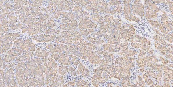 a01272 2 gls primary antibodies ihc testing 4
