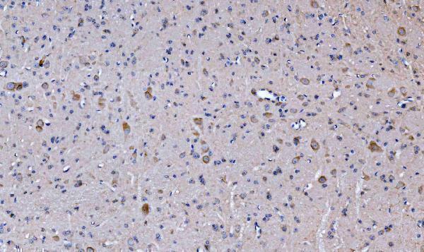 a01272 2 gls primary antibodies ihc testing 5
